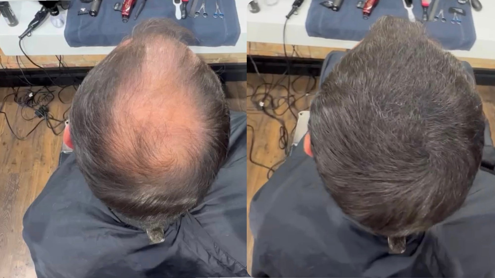 Regain Your Youthful Look: Male Hair Loss Reversed with Hair Fibres