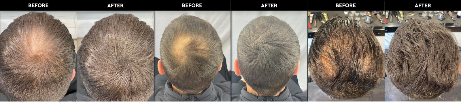 Transform Your Hair in Minutes with HLS Hair Fibre: Fuller Hair, Instant Confidence