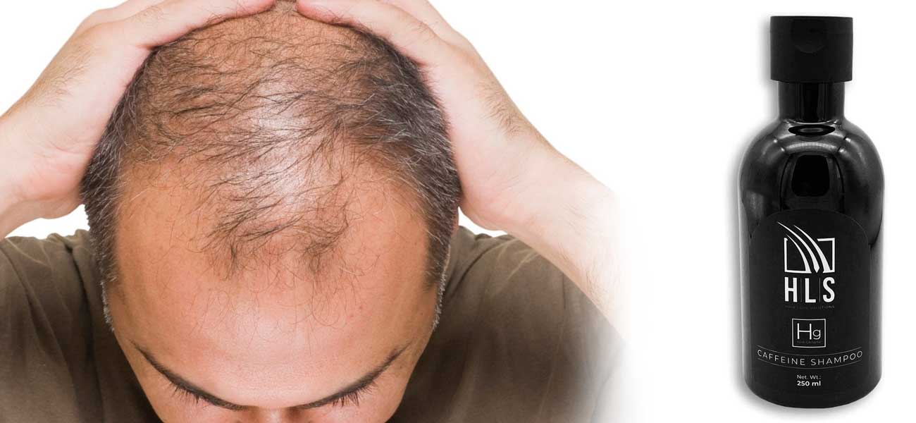 Hair Fibres: Say Goodbye to Thinning Hair with HLS
