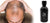 Hair Fibres: Say Goodbye to Thinning Hair with HLS