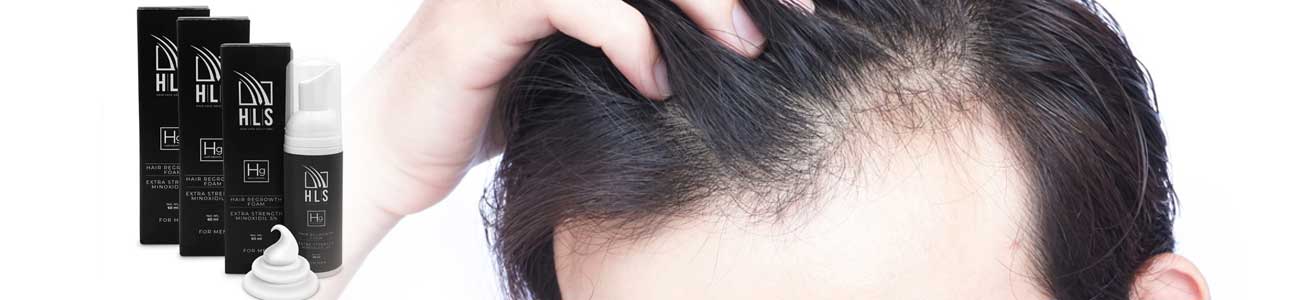 Hair loss facts and helpful information